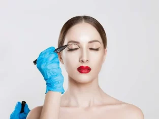 eyelidsurgery