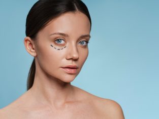 eyelid-surgery-5